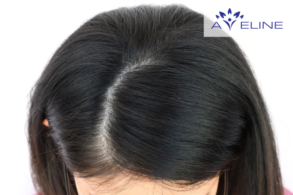 Có nên trả tiền để phá ngôi tóc không? 