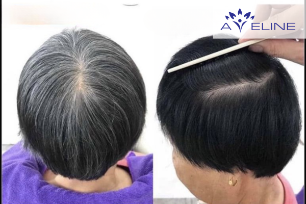 Cách nhuộm tóc đen cho người già an toàn tại nhà 