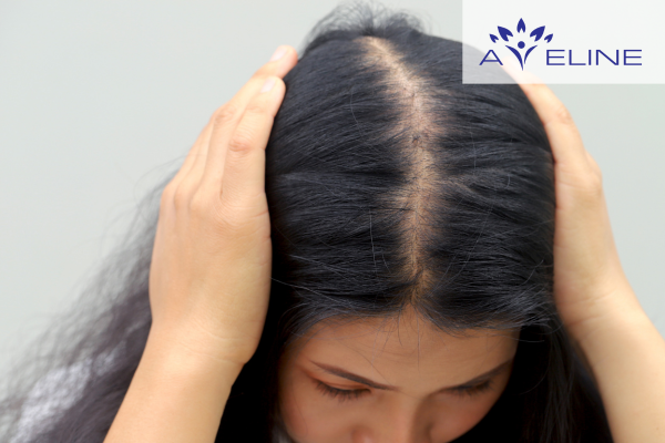 Tóc mỏng và thưa dần 